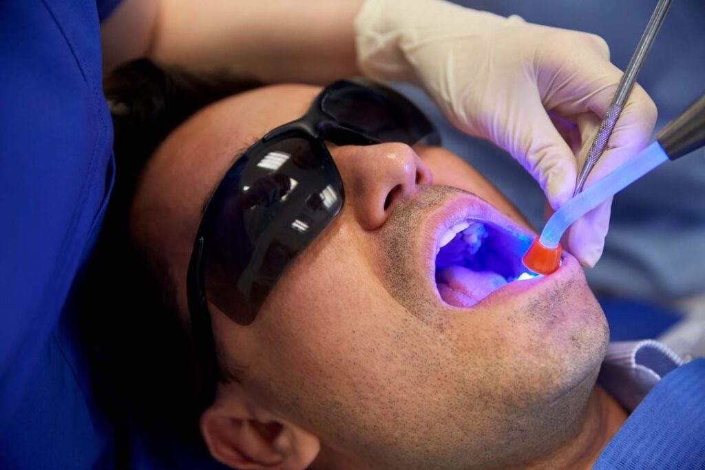 Dental Fillings - Bright Choice Dental